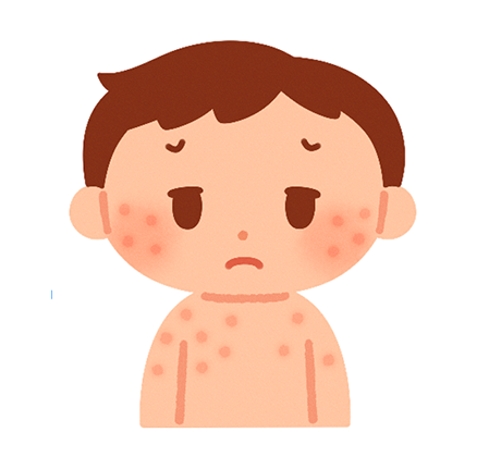 水ぼうそう